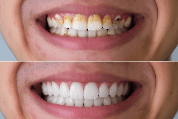 Professional Cleaning results