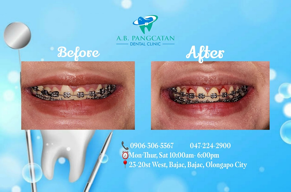 A.B. Pangcatan Dental Clinic gallery