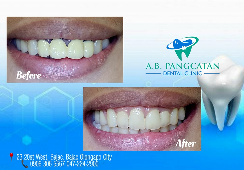 A.B. Pangcatan Dental Clinic gallery
