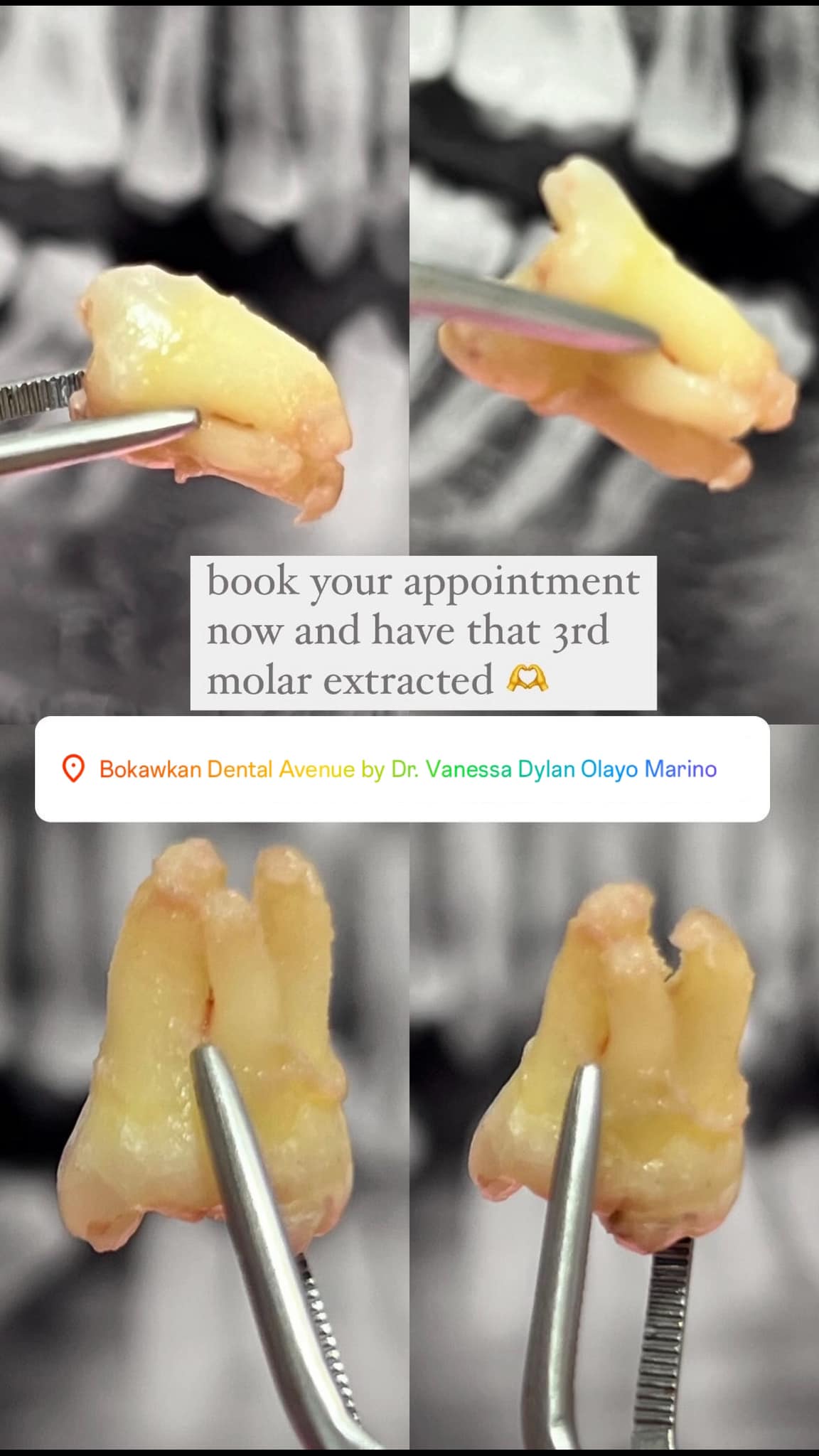 Bokawkan Dental Avenue gallery