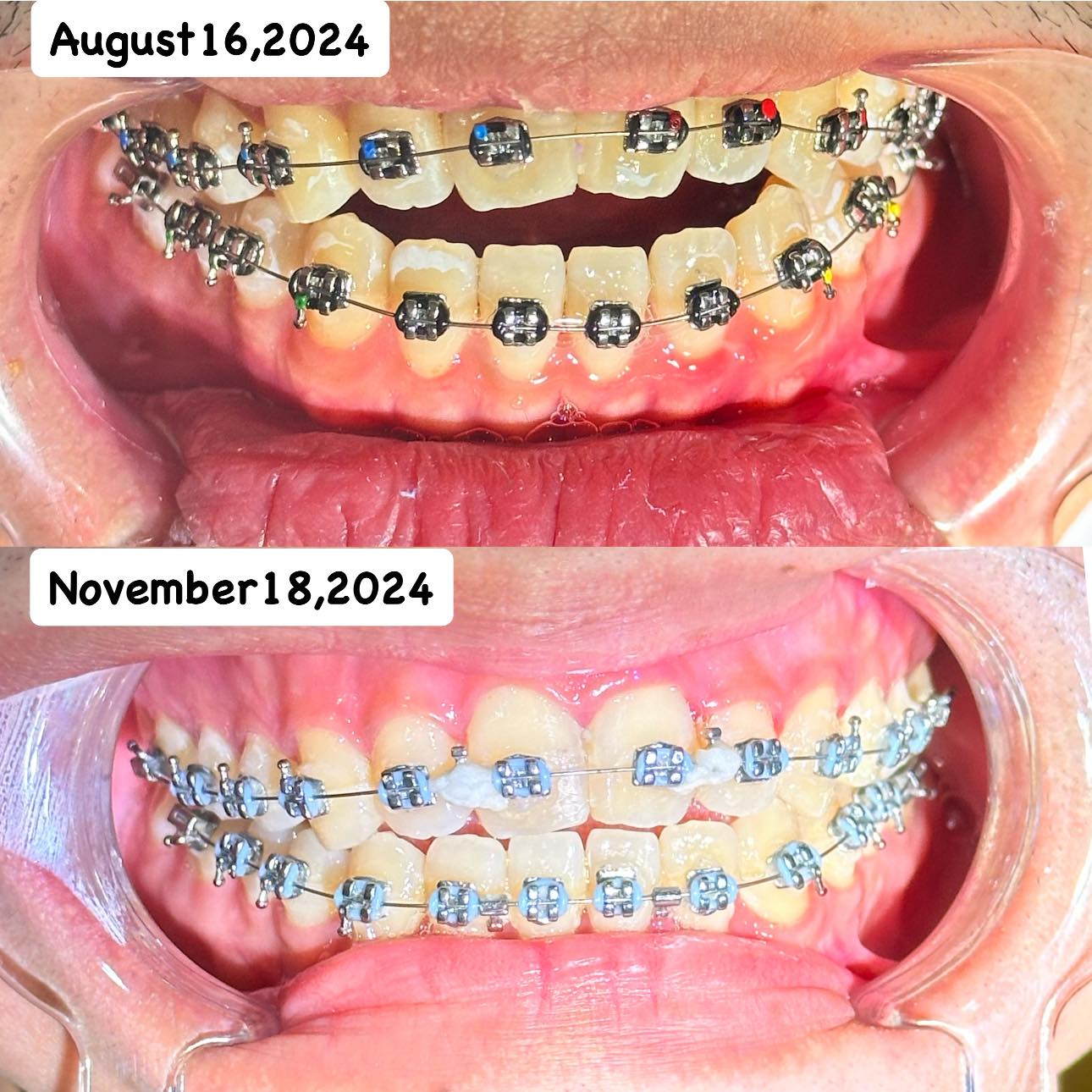 CANDELANZA DENTAL CLINIC ILIGAN BRANCH gallery