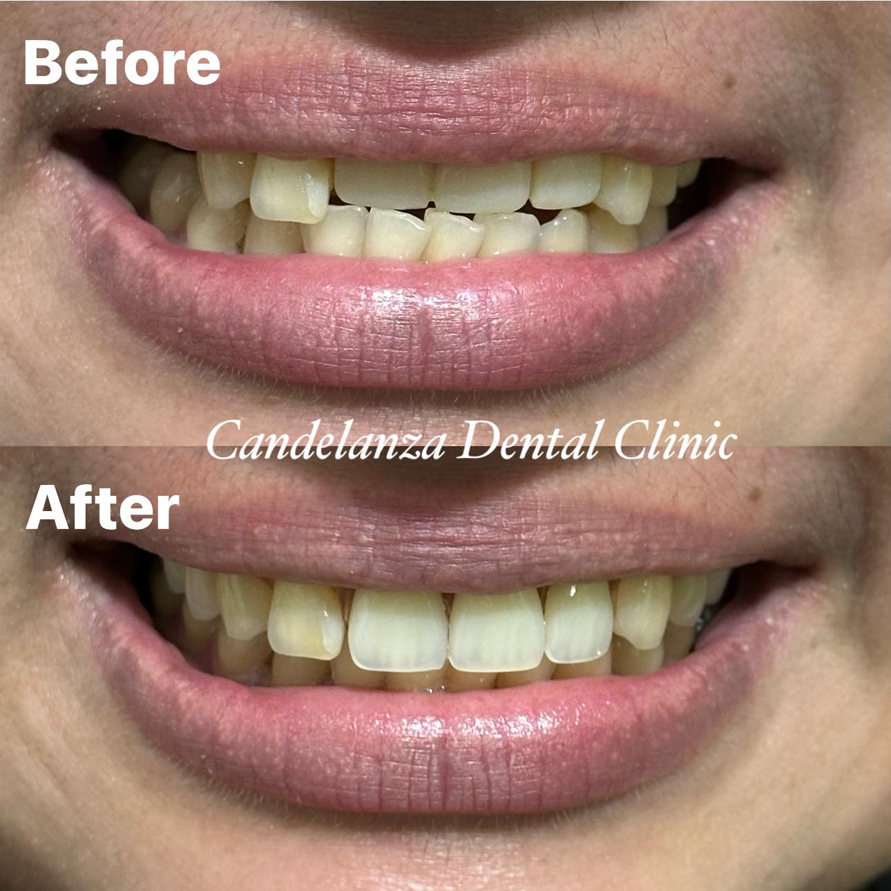 CANDELANZA DENTAL CLINIC ILIGAN BRANCH gallery