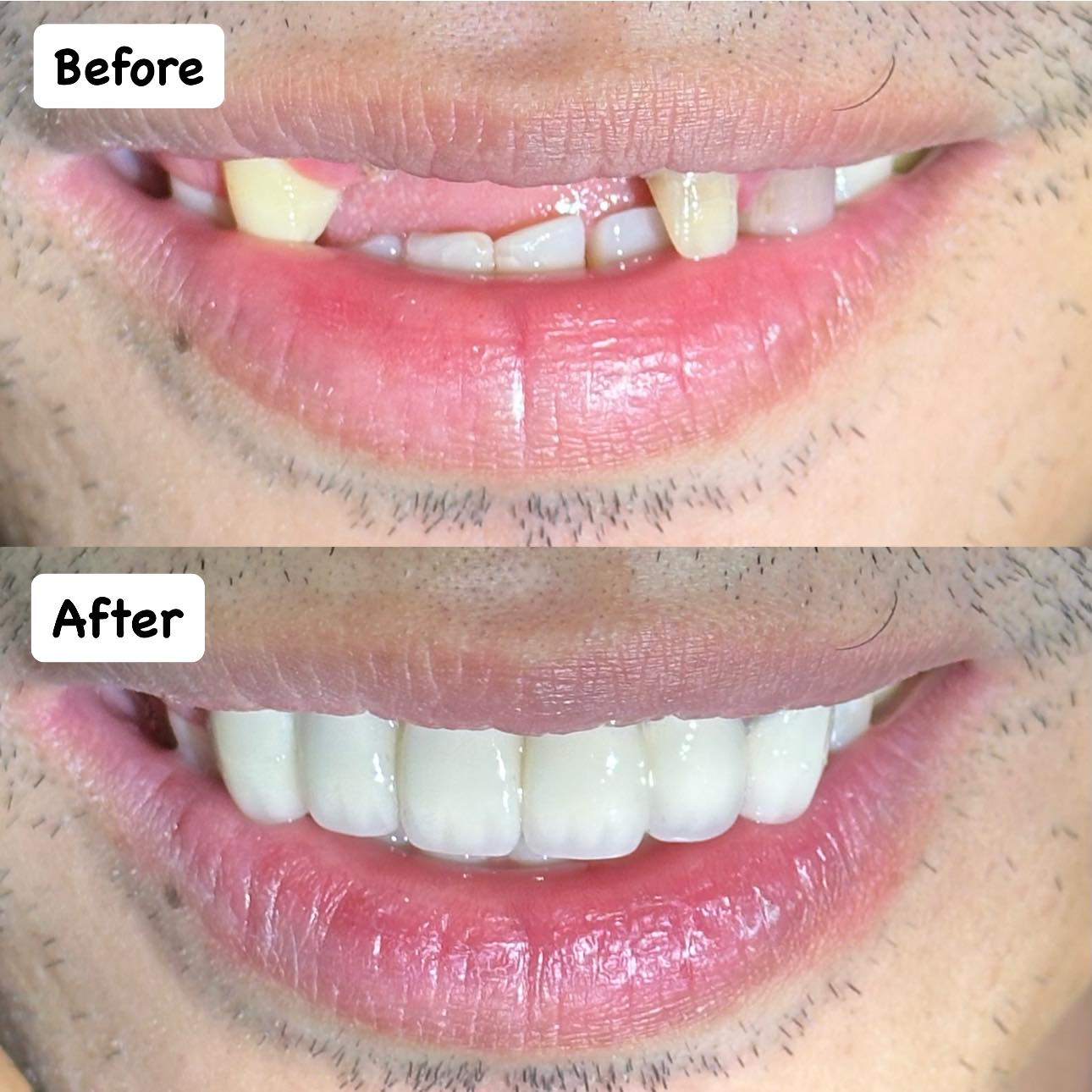 CANDELANZA DENTAL CLINIC ILIGAN BRANCH gallery