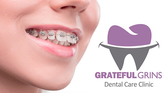 Grateful Grins Dental Clinic - Baao gallery