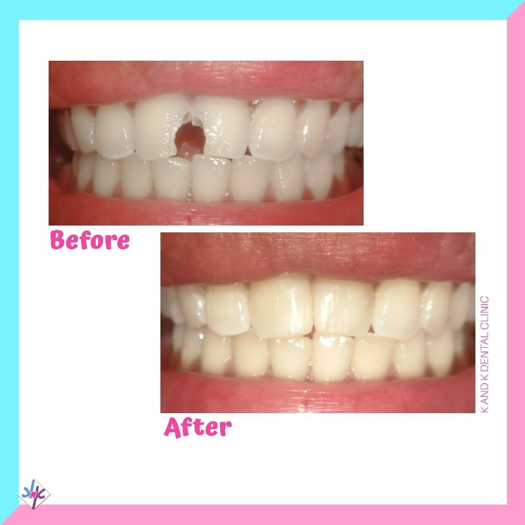 K and K Dental Clinic gallery