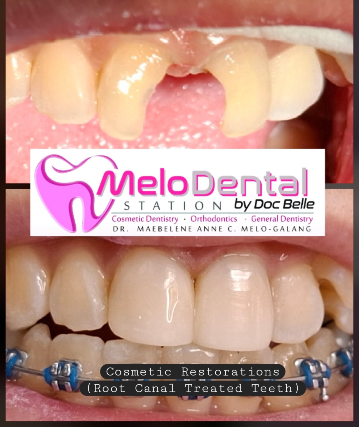 Melo Dental Station- Dr. Maebelene Melo-Galang gallery