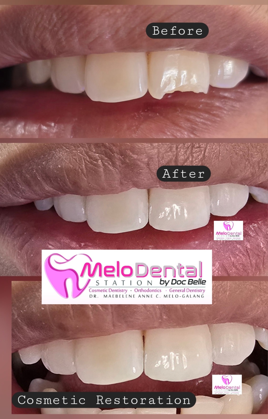 Melo Dental Station- Dr. Maebelene Melo-Galang gallery