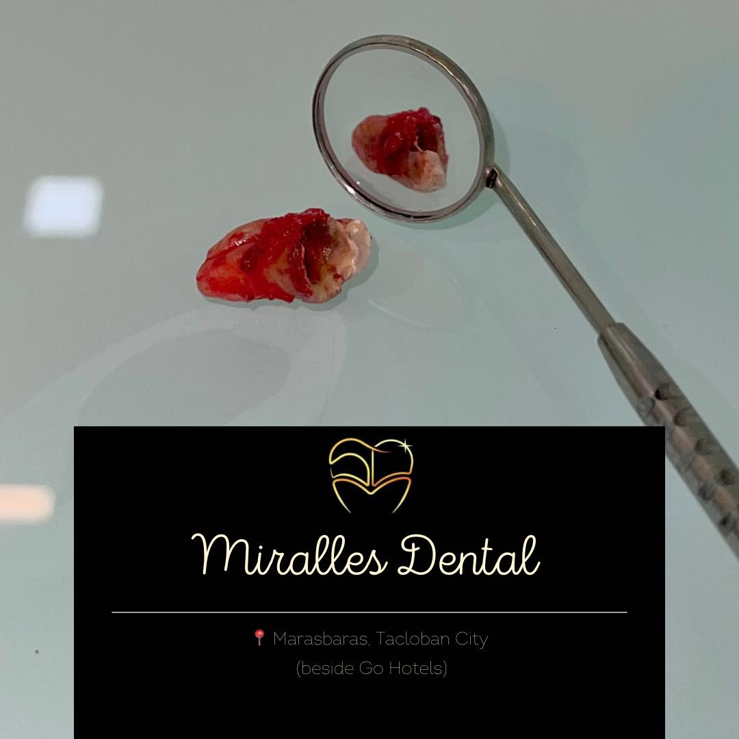 Miralles Dental gallery