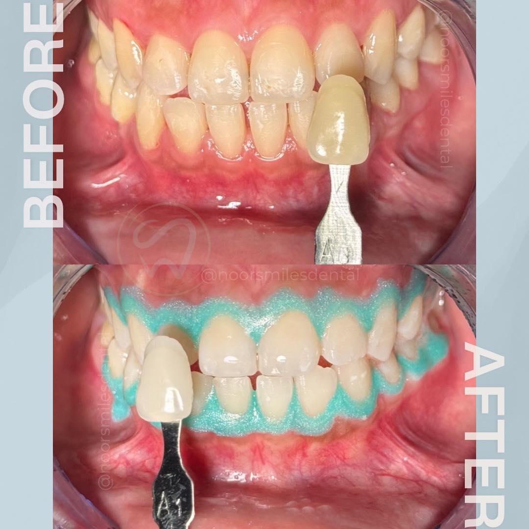 Noor Smiles Dental Clinic gallery