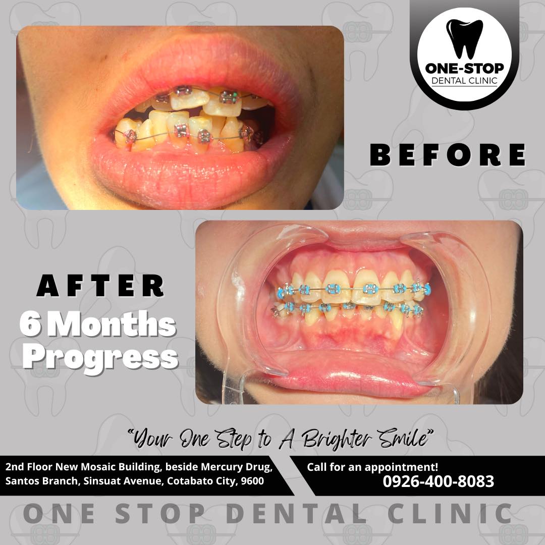 One-Stop Dental Clinic gallery