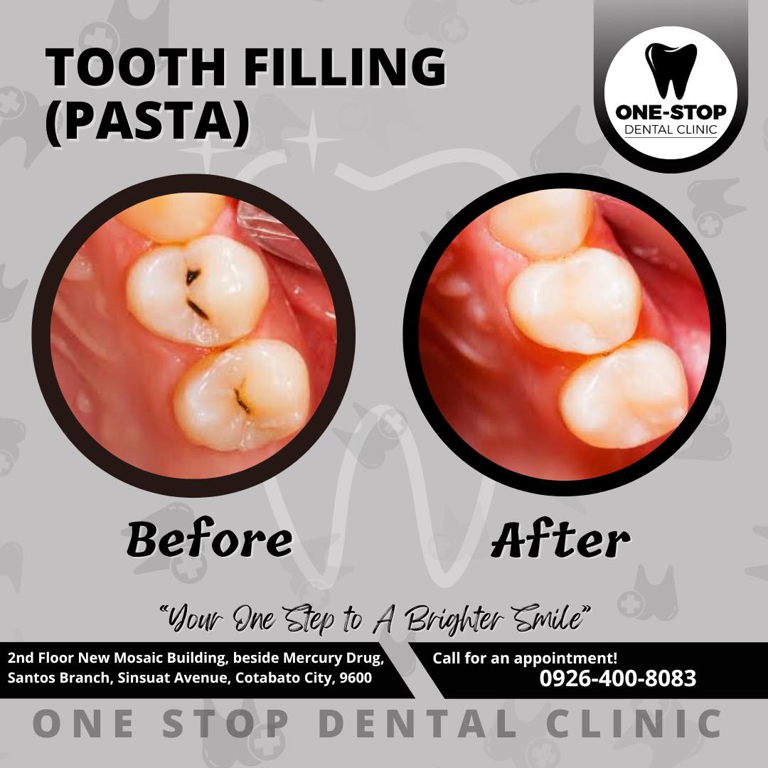 One-Stop Dental Clinic gallery