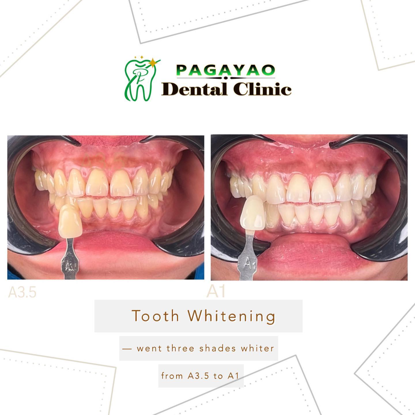 Pagayao Dental Clinic gallery