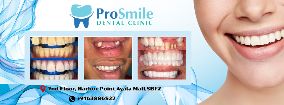 Prosmile Dental clinic Subic gallery