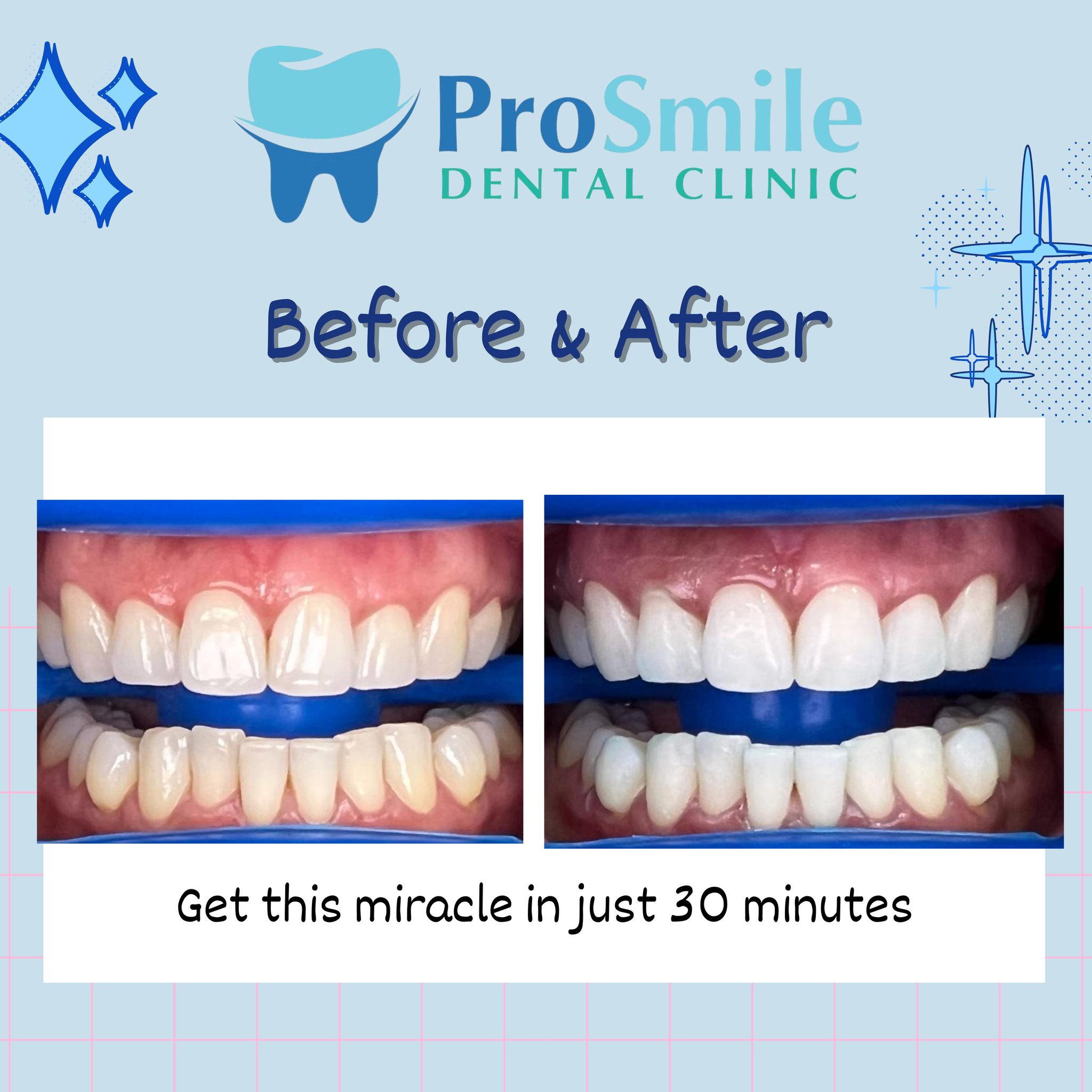 Prosmile Dental clinic Subic gallery