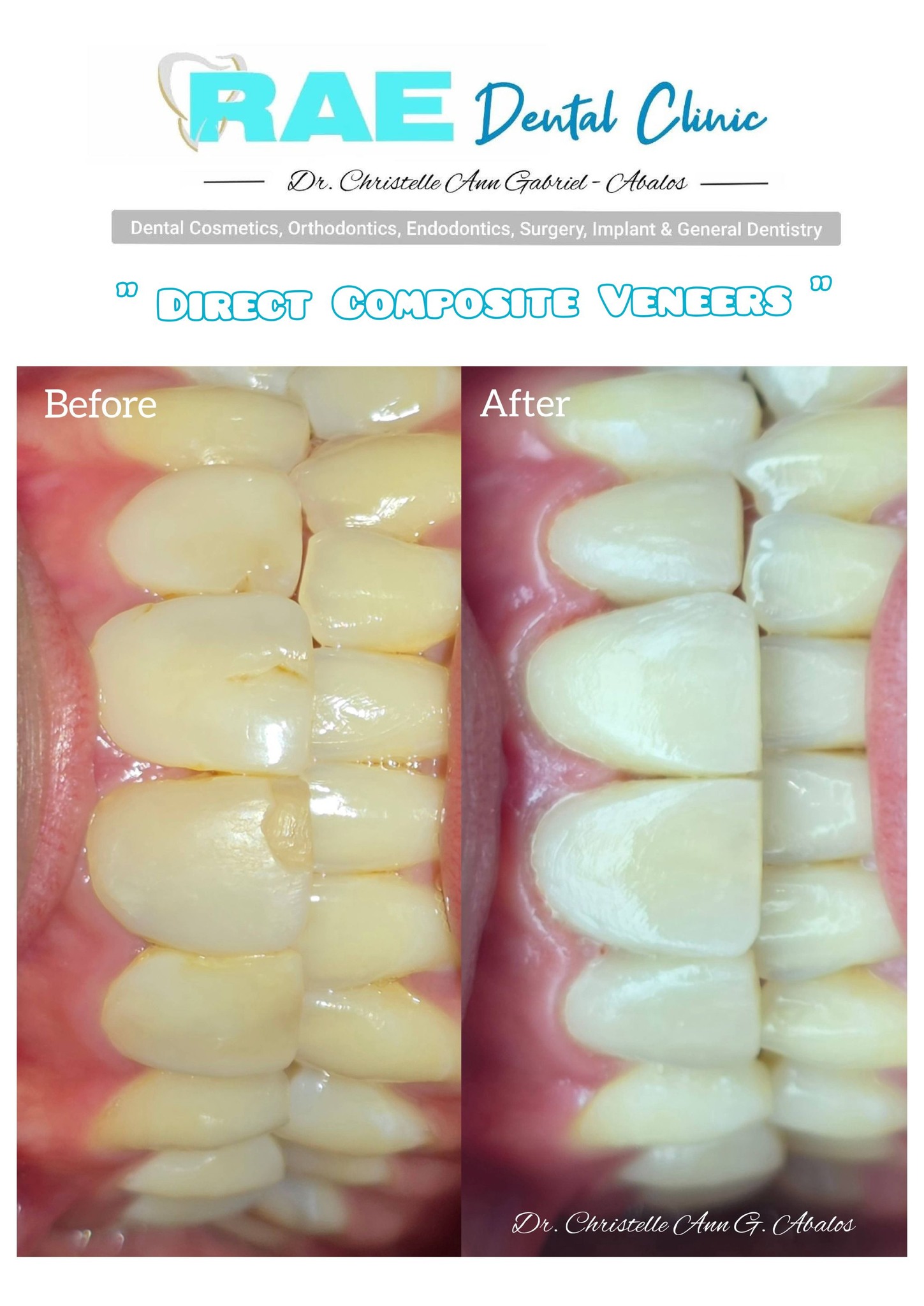 Rae Dental Clinic Dagupan gallery