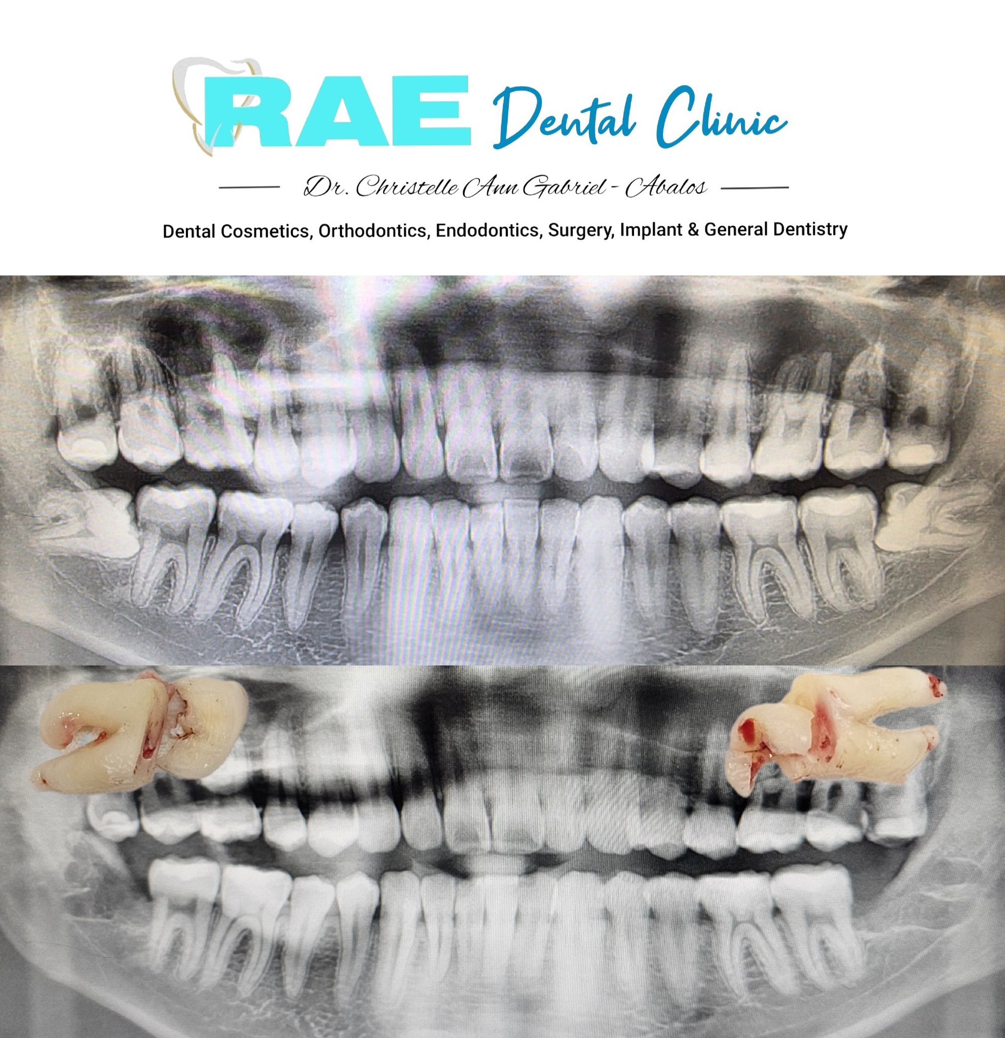 Rae Dental Clinic Dagupan gallery