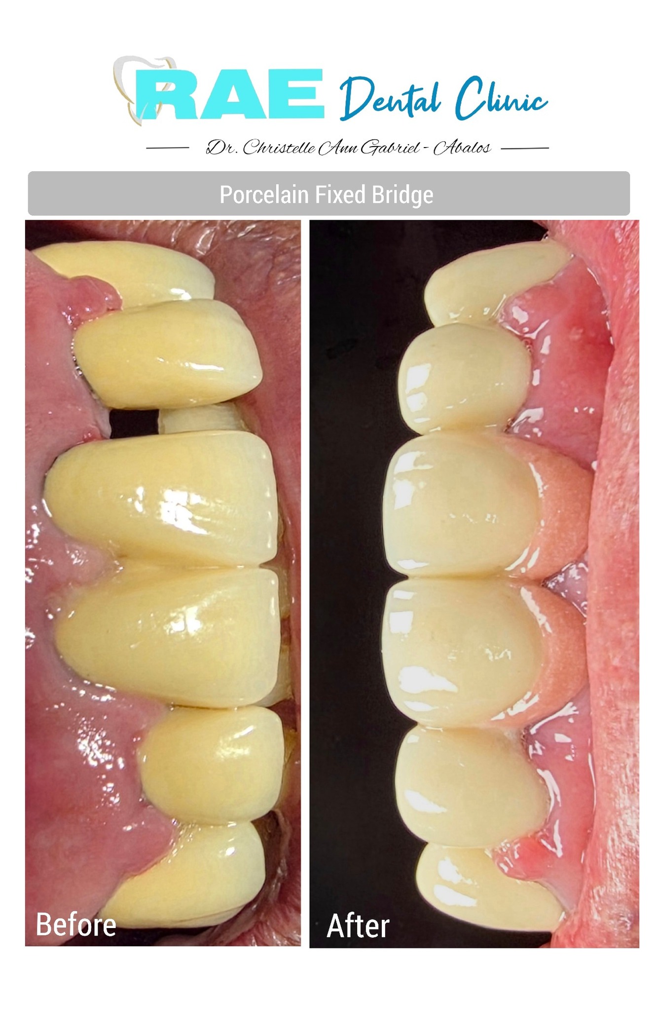 Rae Dental Clinic Dagupan gallery