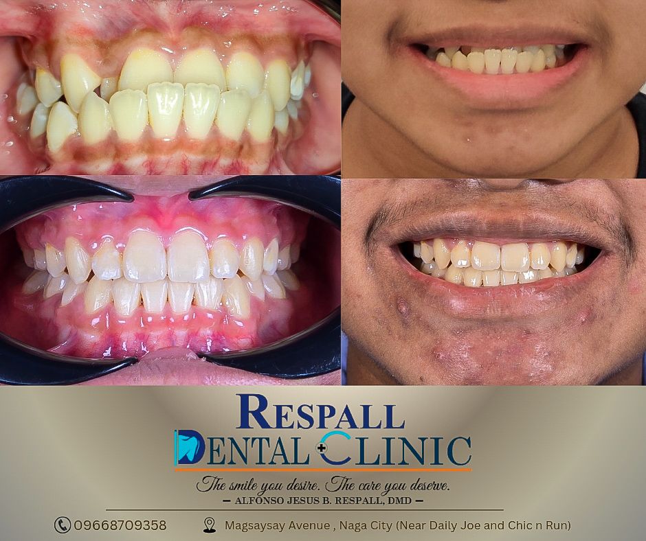 Respall Dental Clinic - Naga gallery