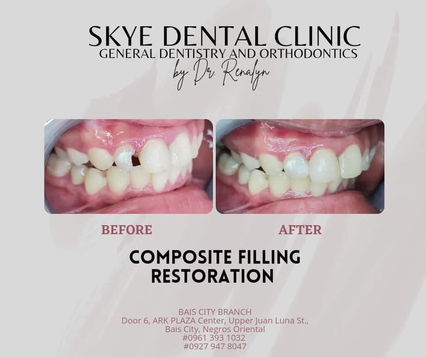 SKYE DENTAL CLINIC- BAIS CITY gallery