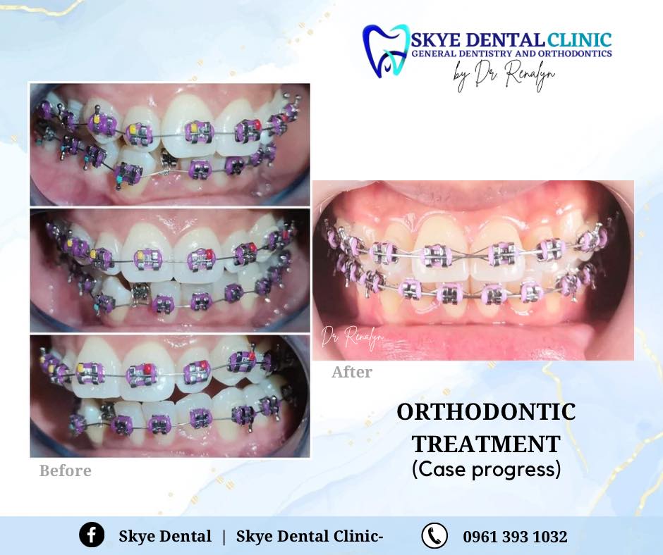 SKYE DENTAL CLINIC- BAIS CITY gallery