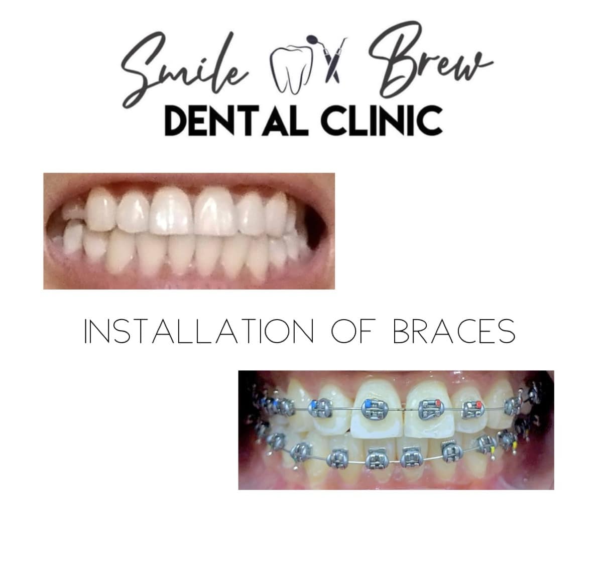 Smile & Brew Dental Clinic - Mangaldan gallery
