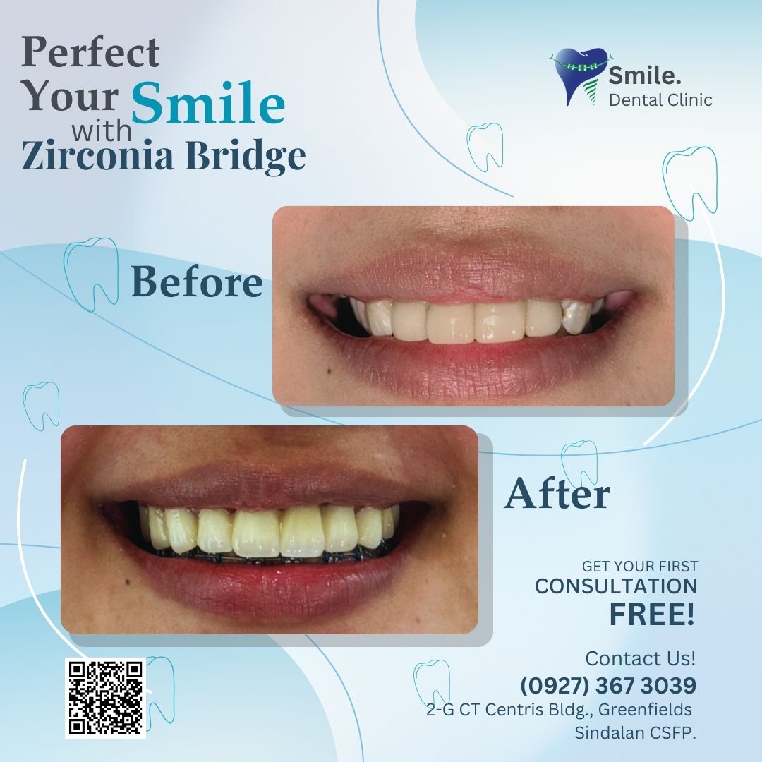 Smile Dental Clinic Pampanga gallery