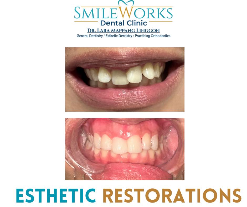 SmileWorks Dental Clinic gallery