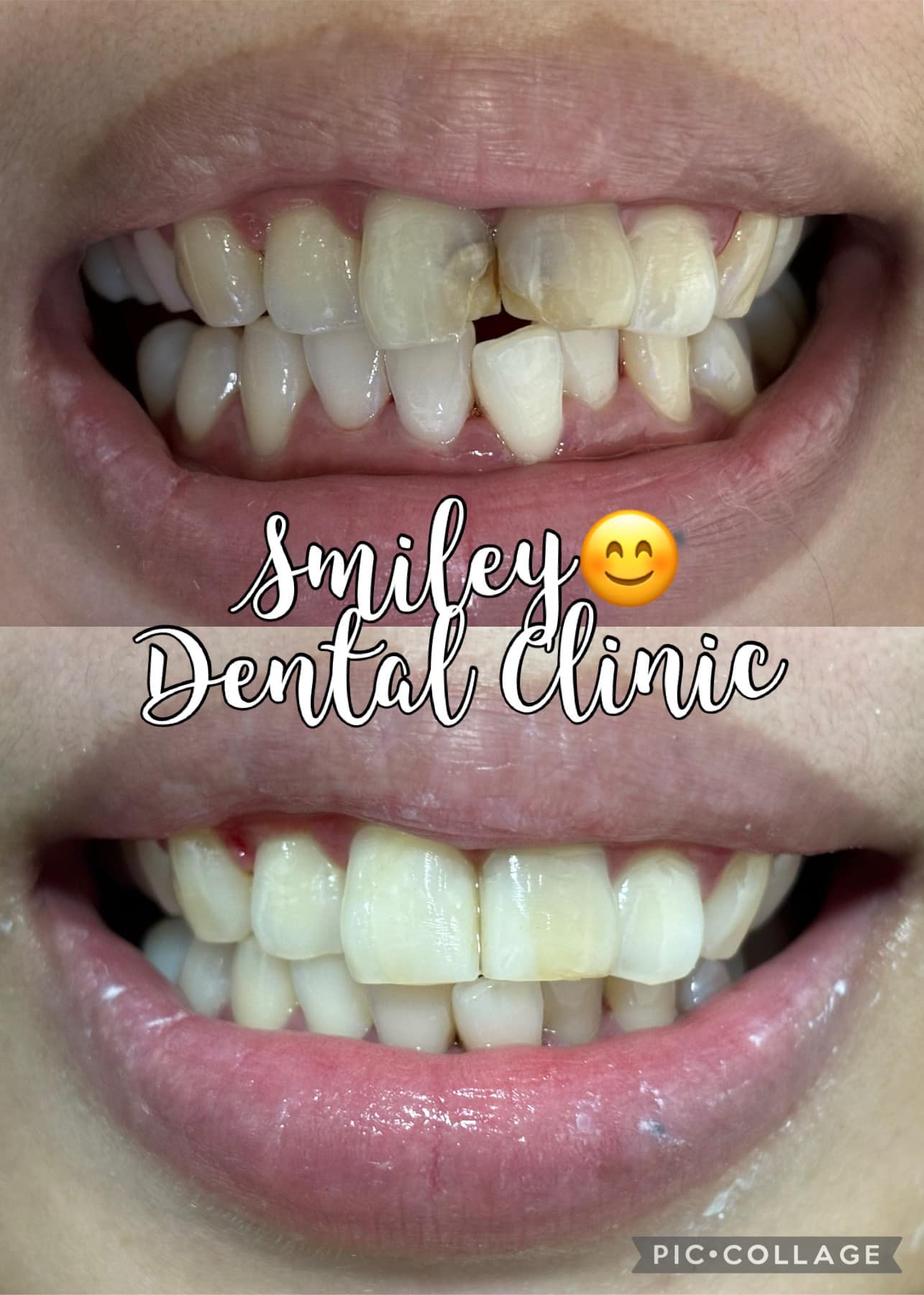 Smiley Dental Clinic gallery