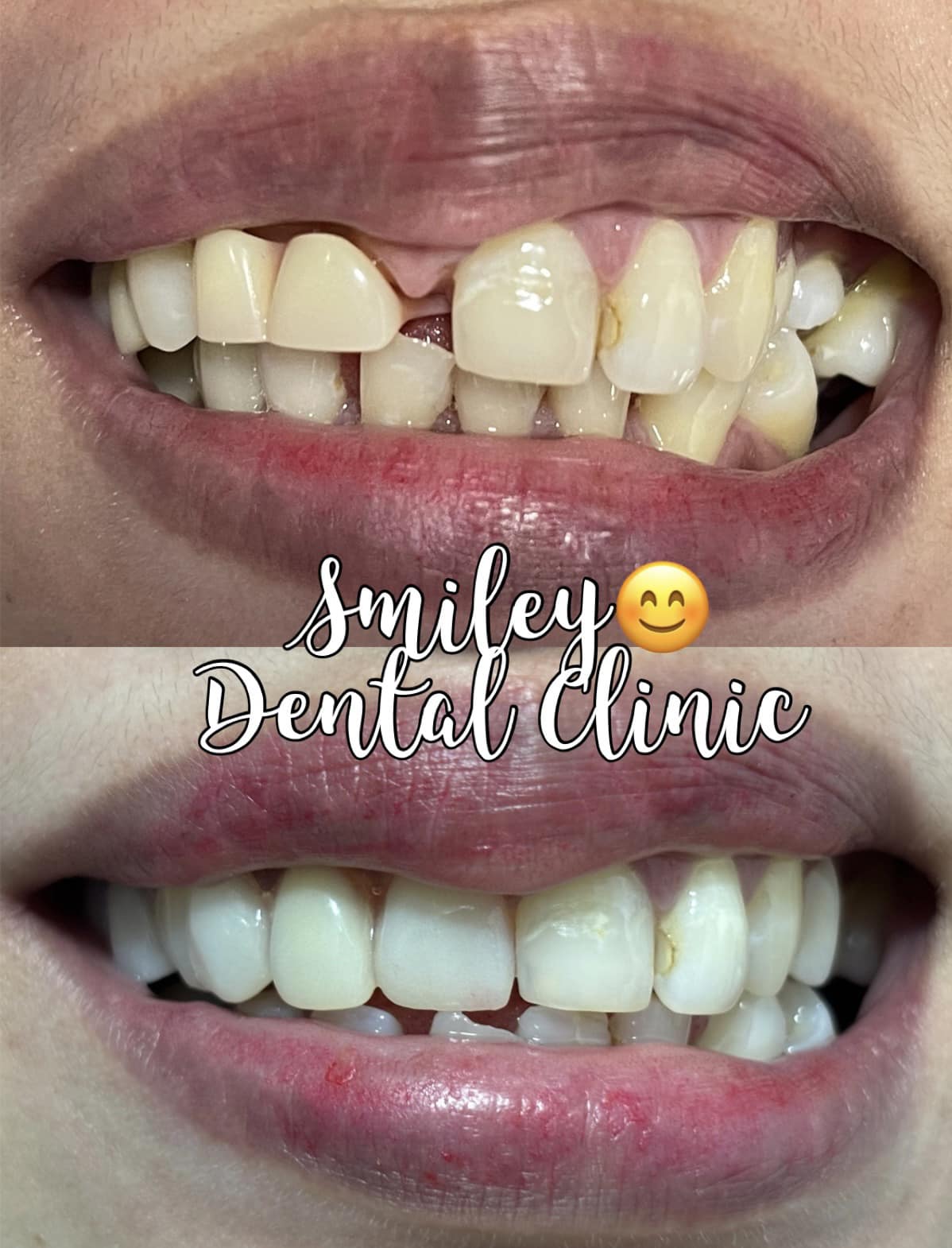 Smiley Dental Clinic gallery