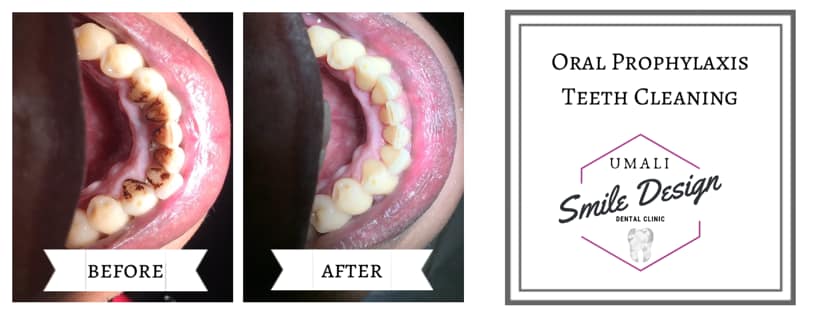 Umali Dental Clinic gallery