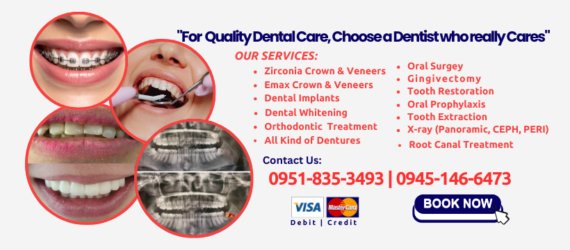 VALDEZ DENTAL CLINIC - Dagupan City Pangasinan gallery