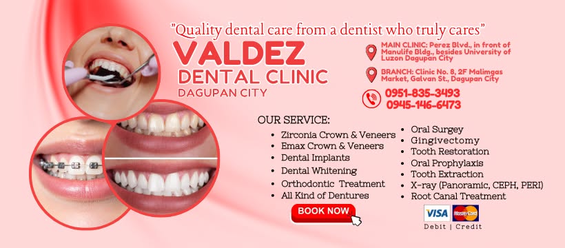VALDEZ DENTAL CLINIC - Dagupan City Pangasinan gallery