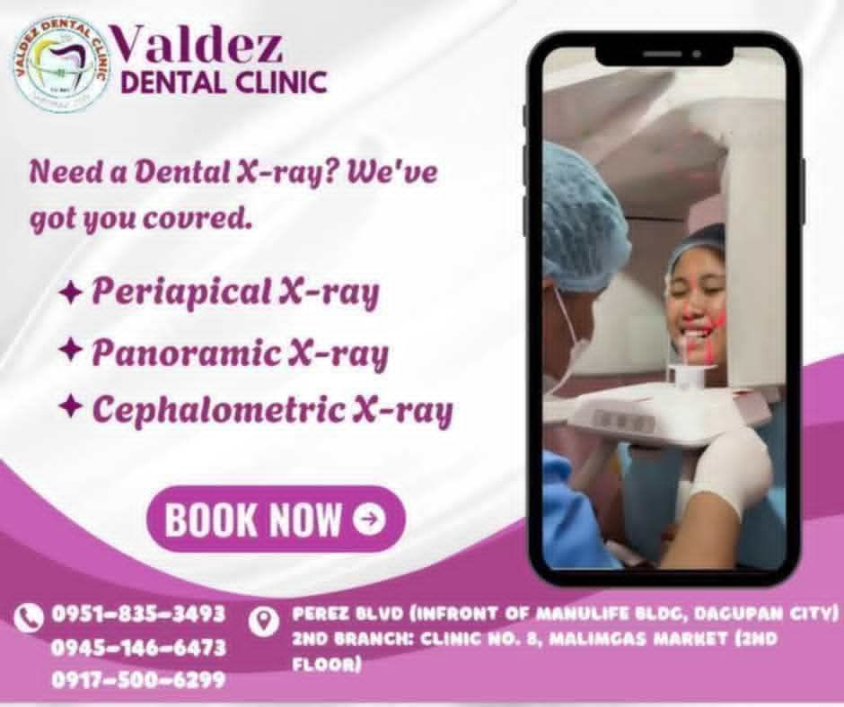 VALDEZ DENTAL CLINIC - Dagupan City Pangasinan gallery
