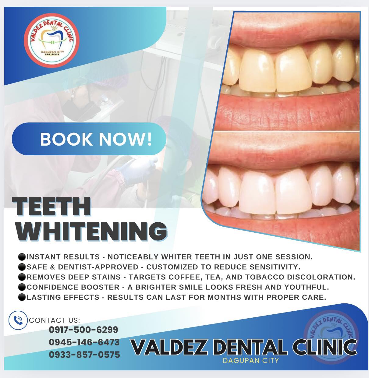 VALDEZ DENTAL CLINIC - Dagupan City Pangasinan gallery
