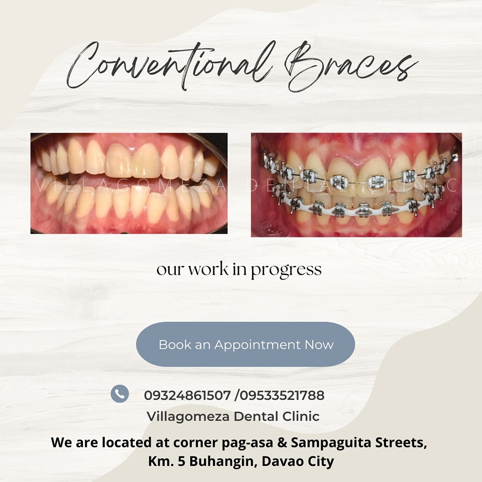 Villagomeza Dental Clinic gallery