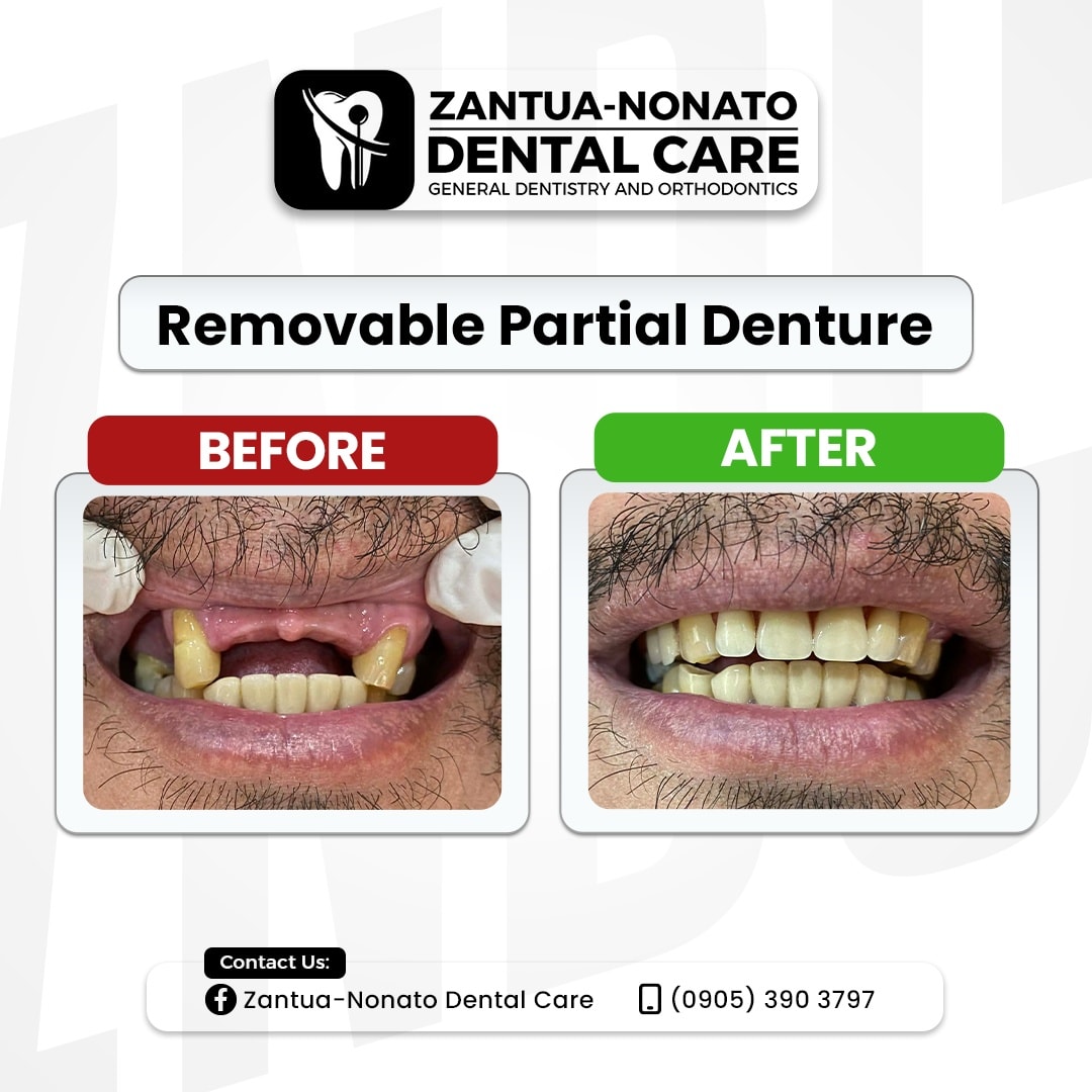 Zantua - Nonato Dental Care Baao gallery